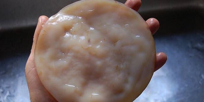 Kombucha na grzybicę paznokci