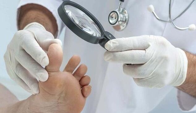 Diagnostyka grzybów