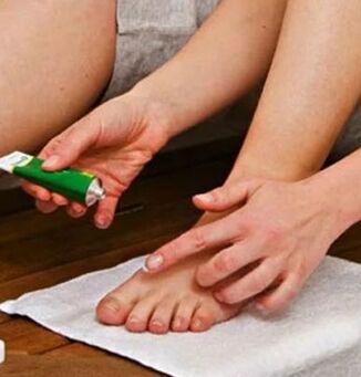 Zastosowanie maści leczniczej do pokonania paznokcia dużego palca z grzybem